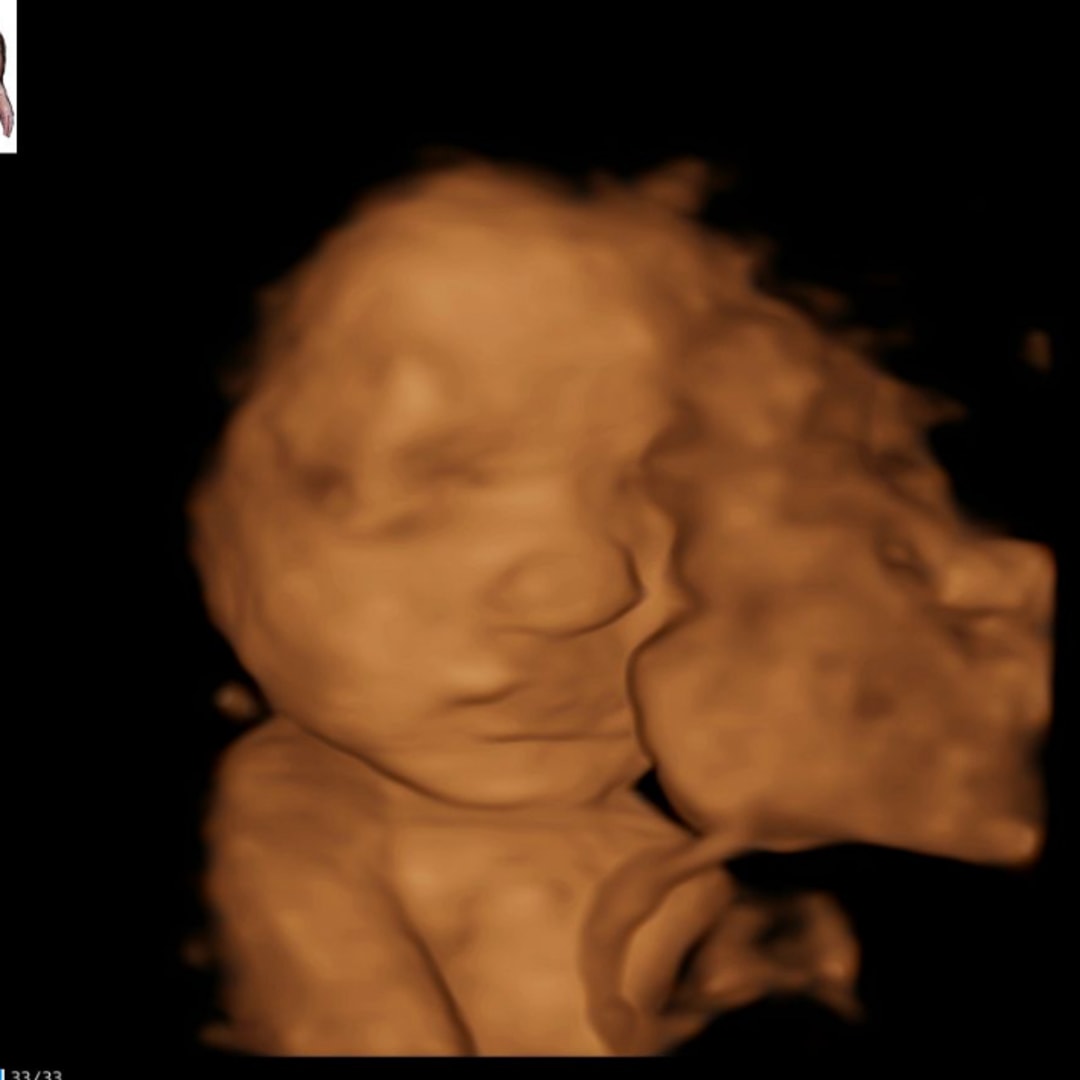 Photo shared by Jenna for their Babylist baby registry.