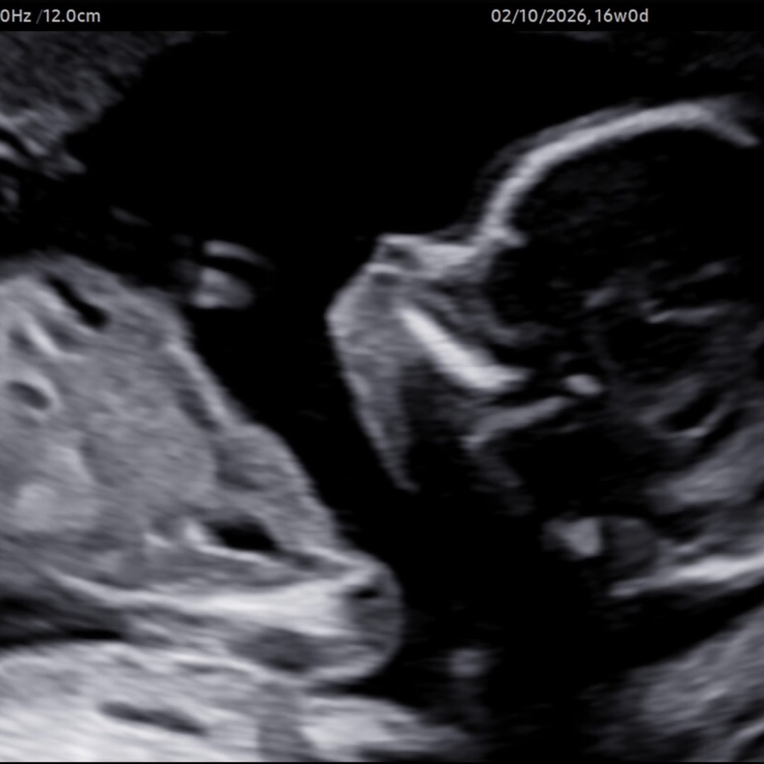 Photo shared by Anisha for their Babylist baby registry.