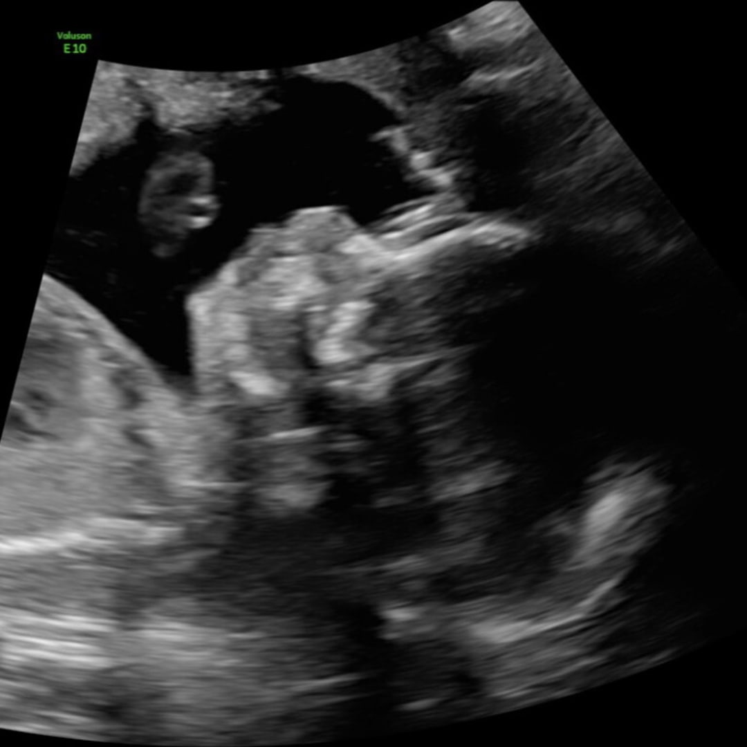 Photo shared by Cailan for their Babylist baby registry.