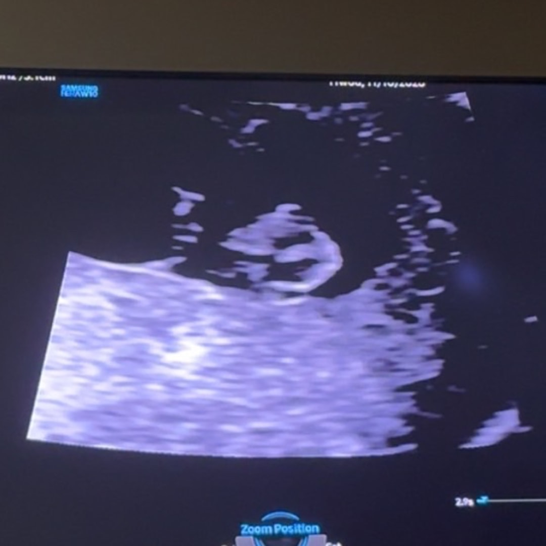 Photo shared by Amy for their Babylist baby registry.