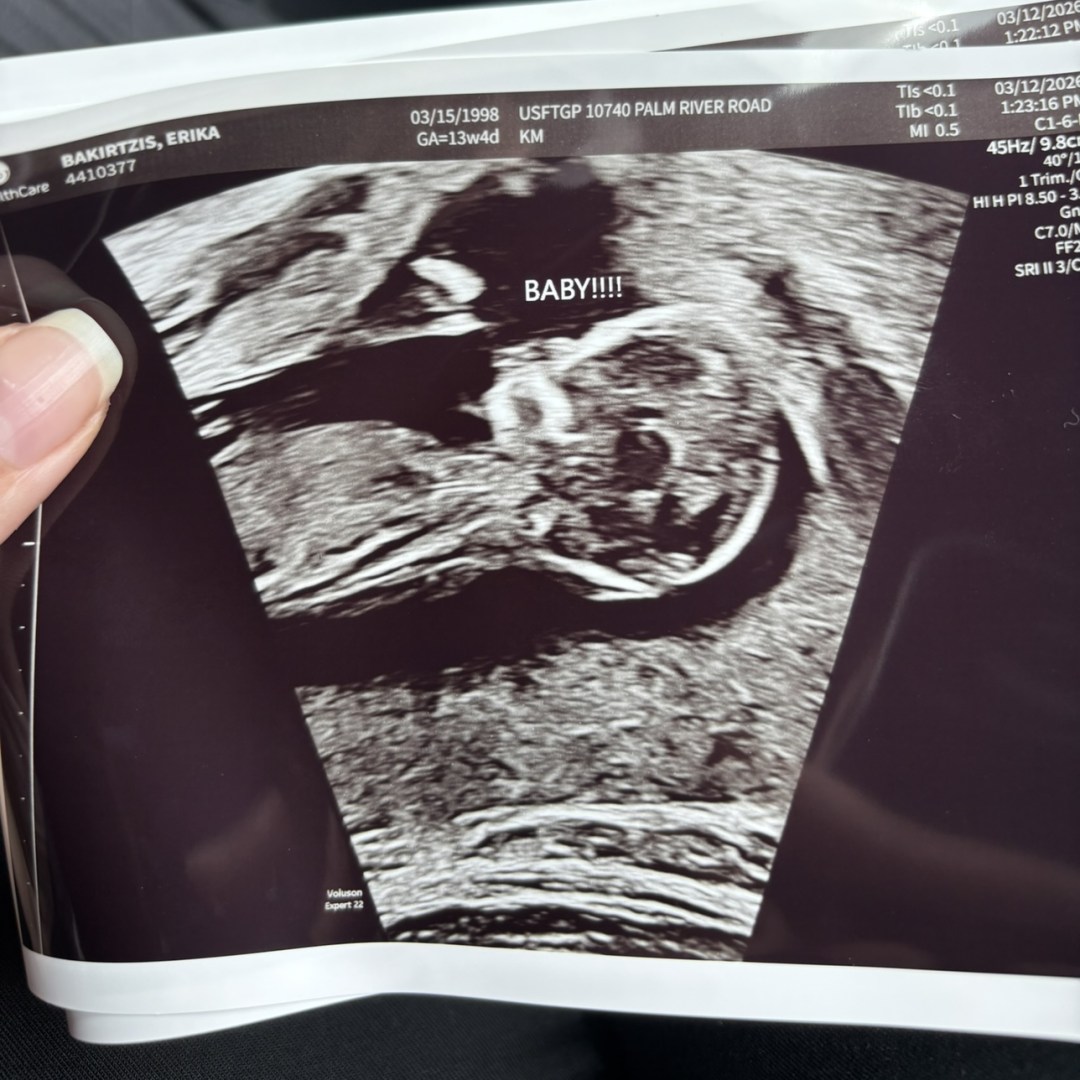 Photo shared by Erika for their Babylist baby registry.