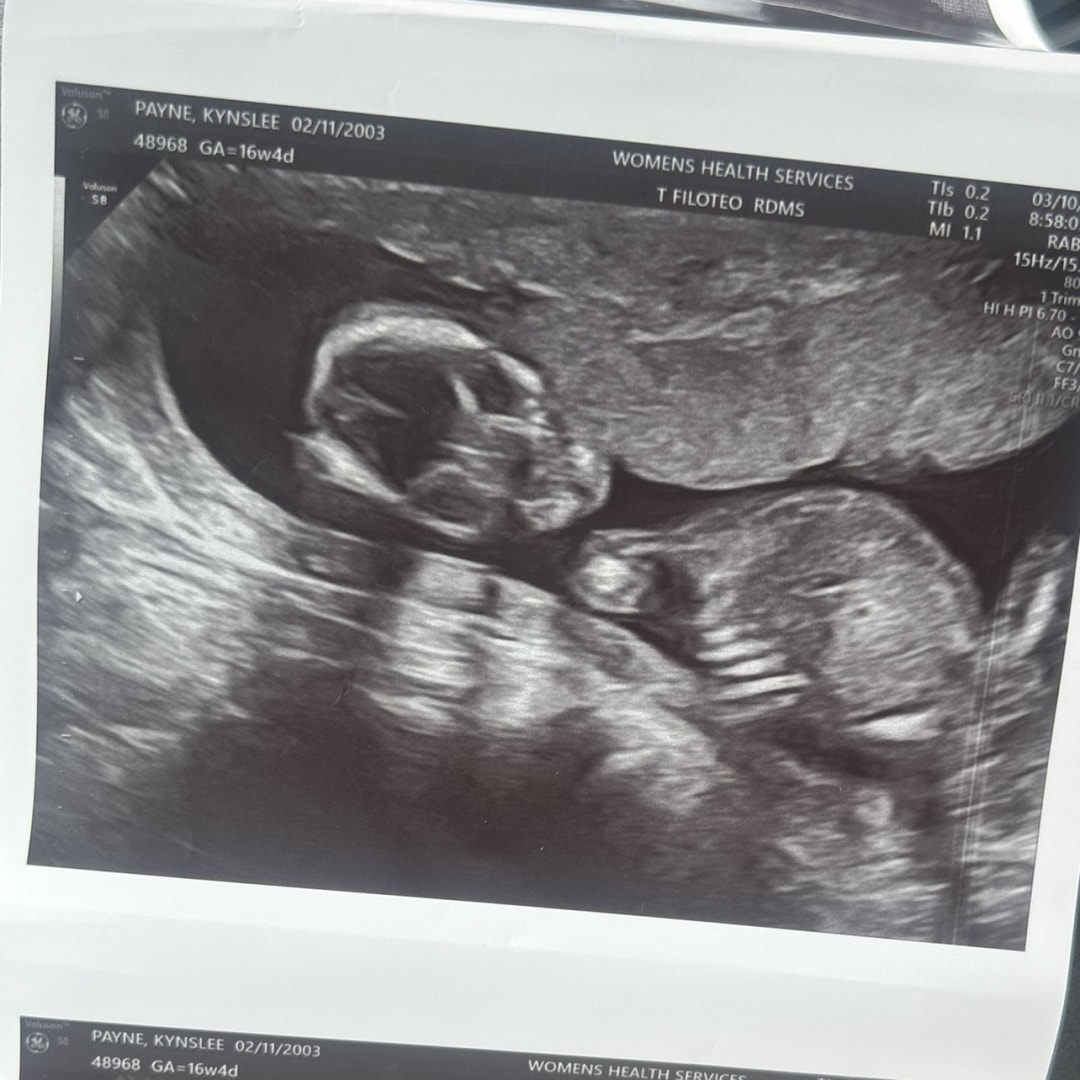 Photo shared by Kynslee for their Babylist baby registry.