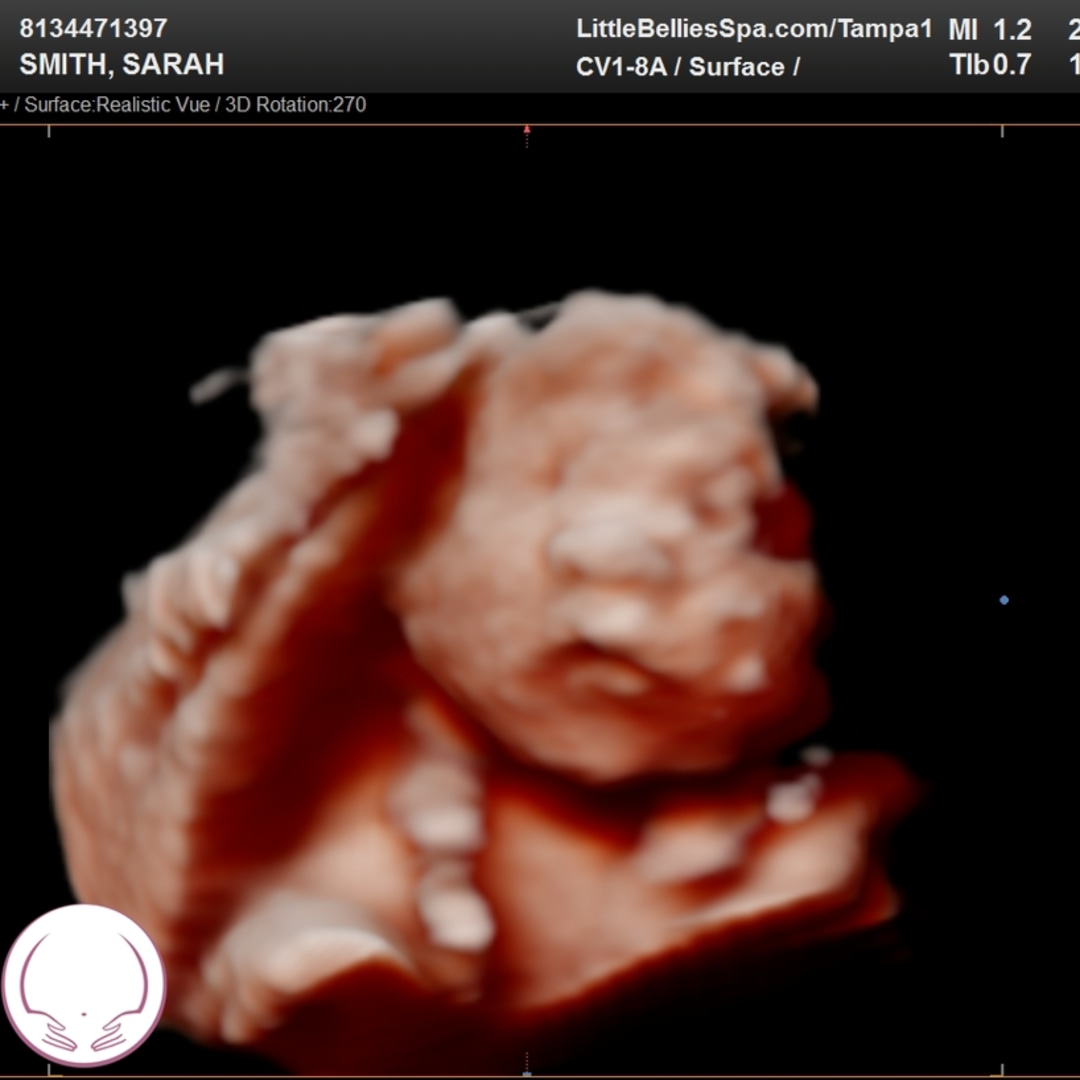 Photo shared by Sarah for their Babylist baby registry.