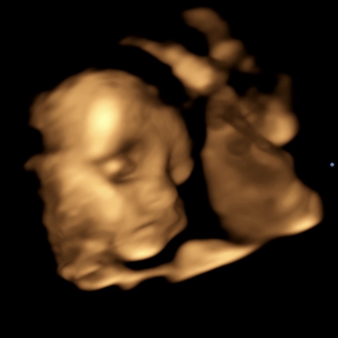 Photo shared by Cassie for their Babylist baby registry.