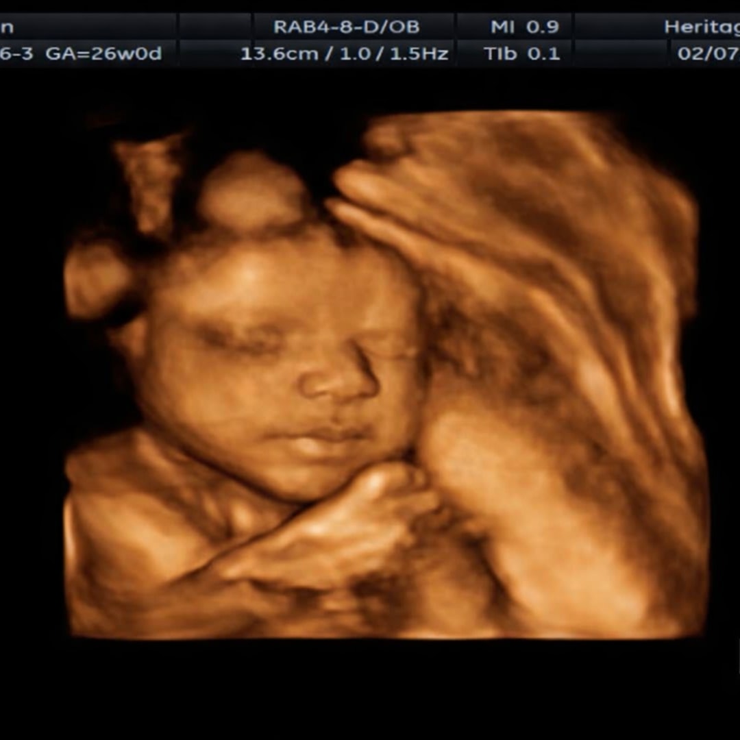 Photo shared by Katelyn for their Babylist baby registry.