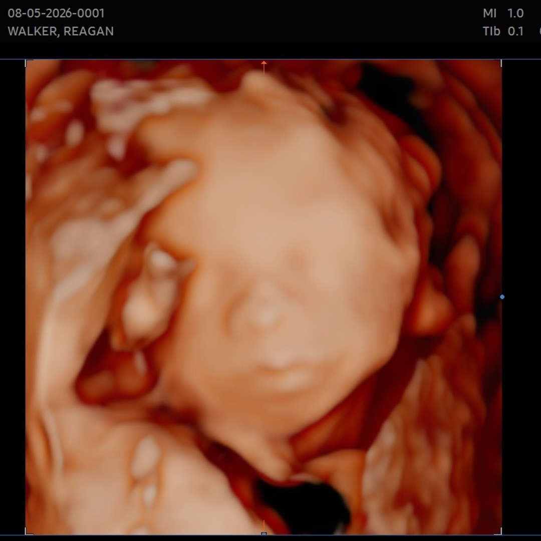 Photo shared by Reagan for their Babylist baby registry.