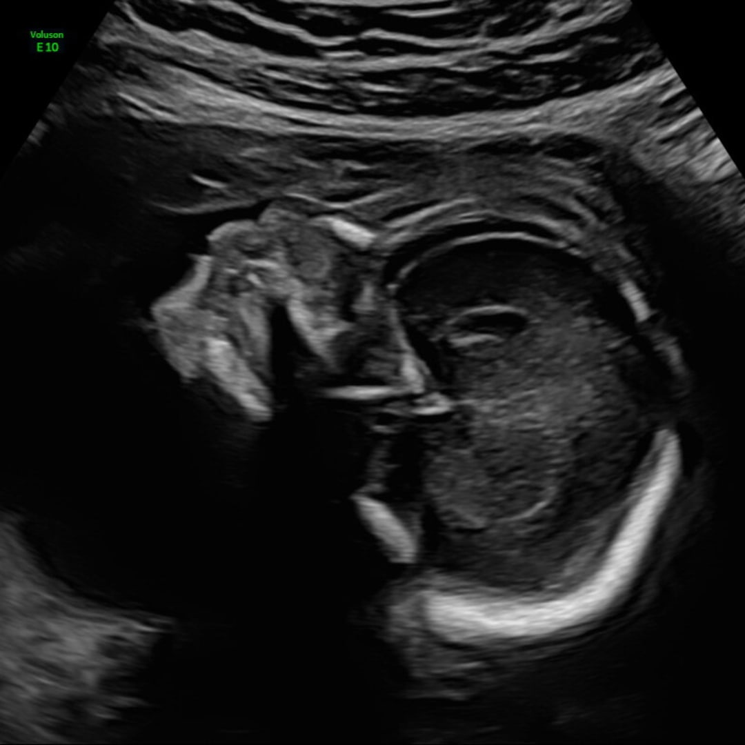 Photo shared by Madison for their Babylist baby registry.