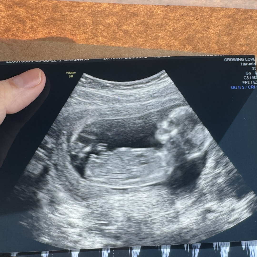 Photo shared by Rebecca for their Babylist baby registry.