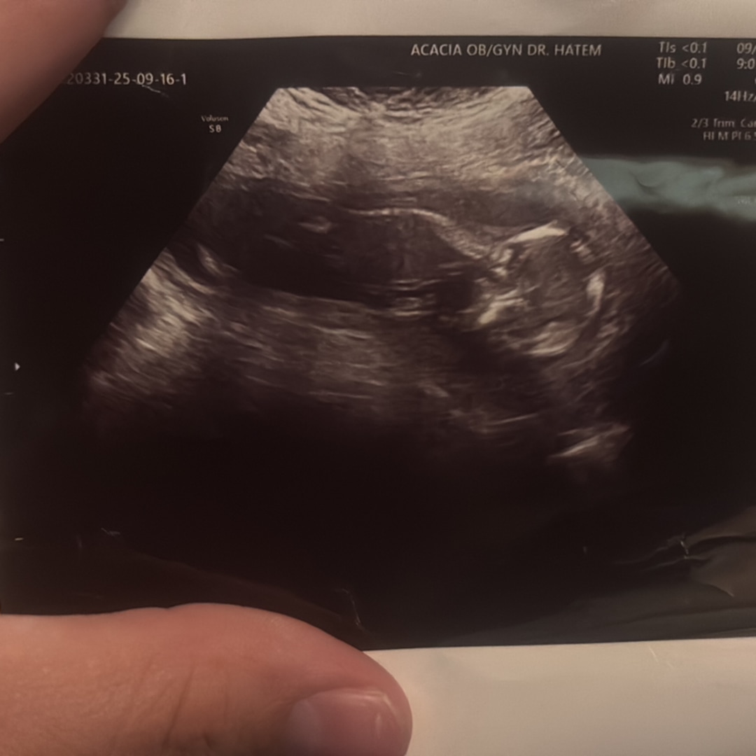 Photo shared by Abcde for their Babylist baby registry.