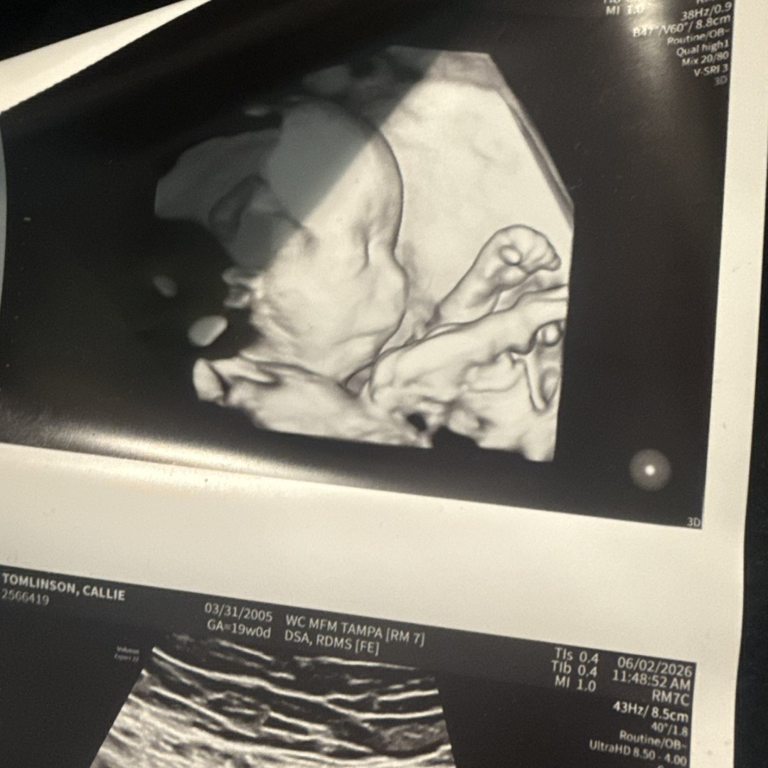 Photo shared by Callie for their Babylist baby registry.