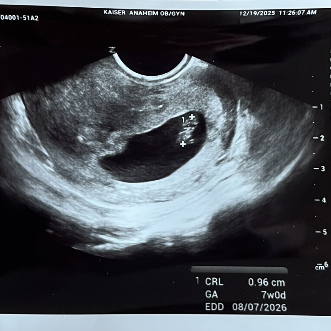 Photo shared by Sam for their Babylist baby registry.