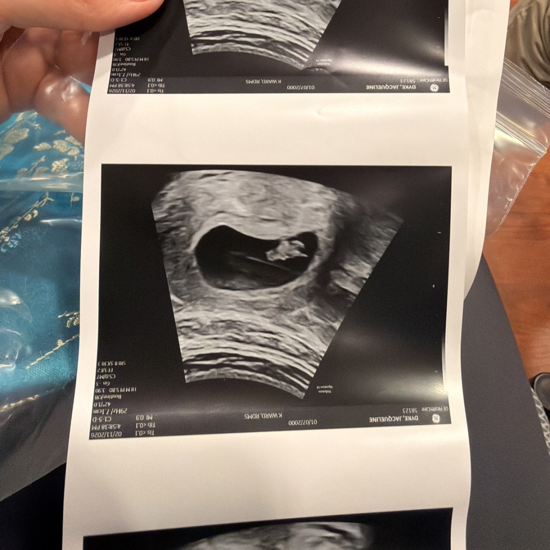 Photo shared by Jackie for their Babylist baby registry.