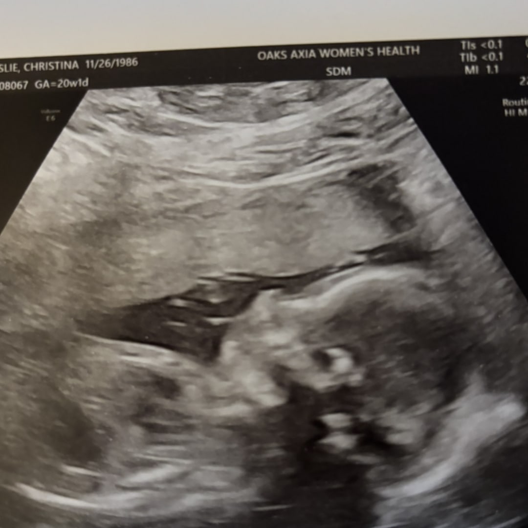 Photo shared by Christina for their Babylist baby registry.
