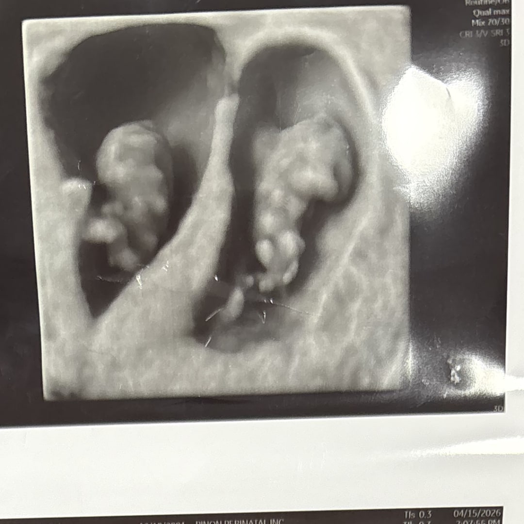 Photo shared by Ganya for their Babylist baby registry.