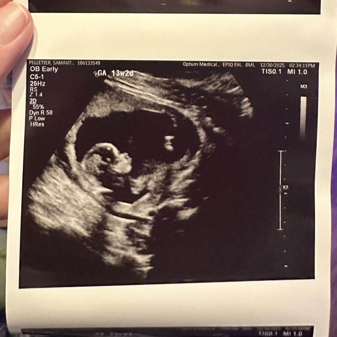 Photo shared by Samantha for their Babylist baby registry.