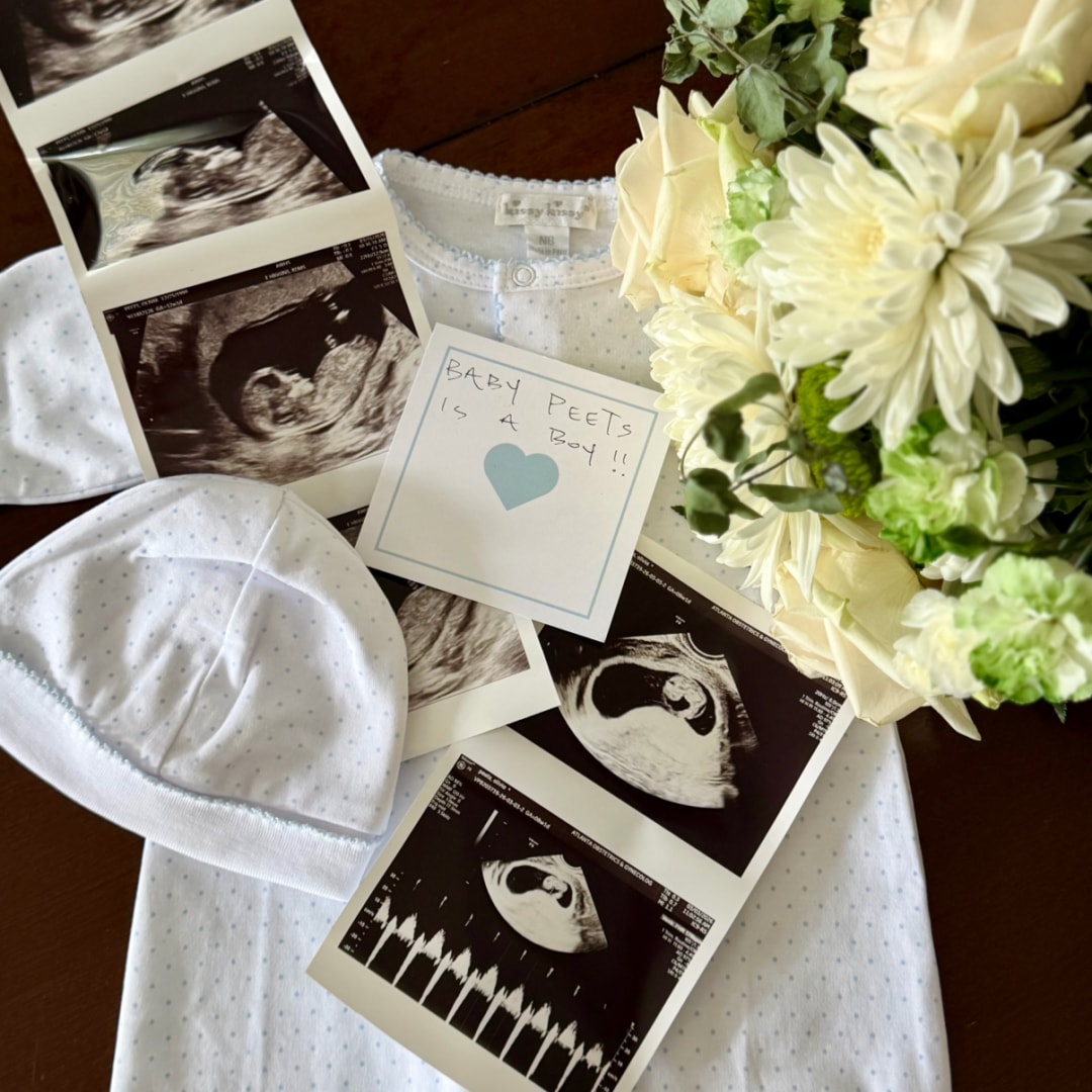 Photo shared by Olivia for their Babylist baby registry.