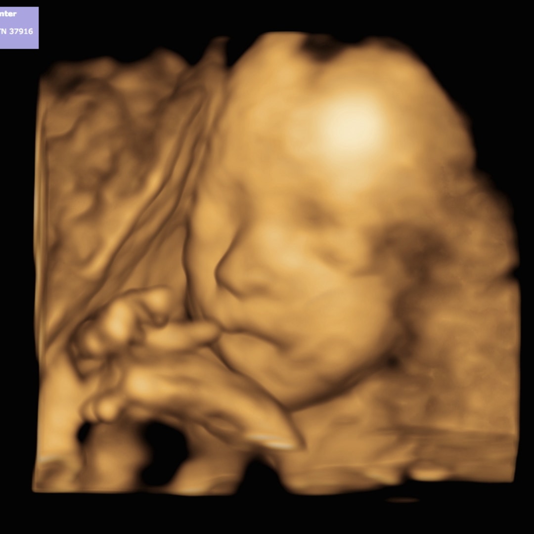 Photo shared by Savonnah for their Babylist baby registry.