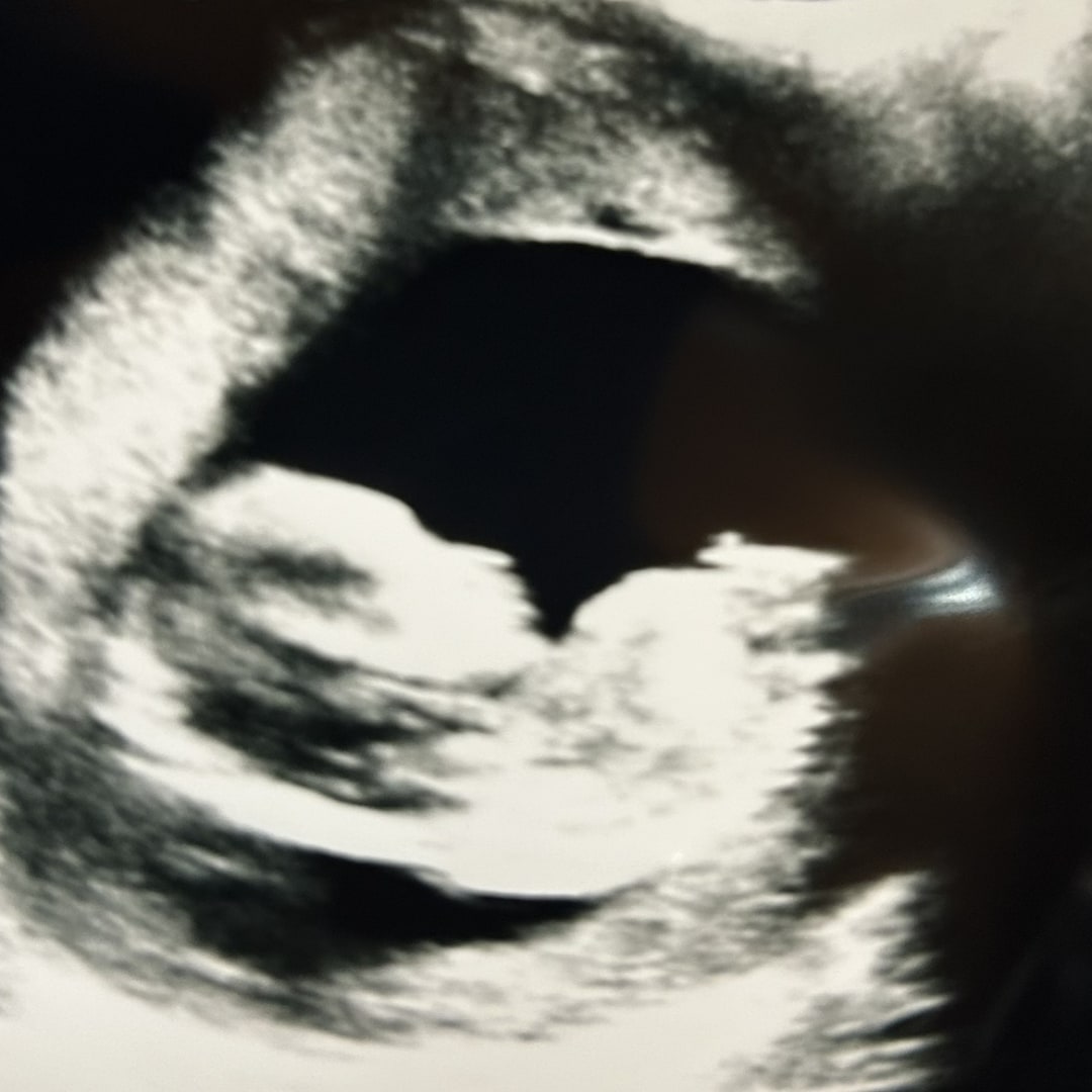 Photo shared by China for their Babylist baby registry.