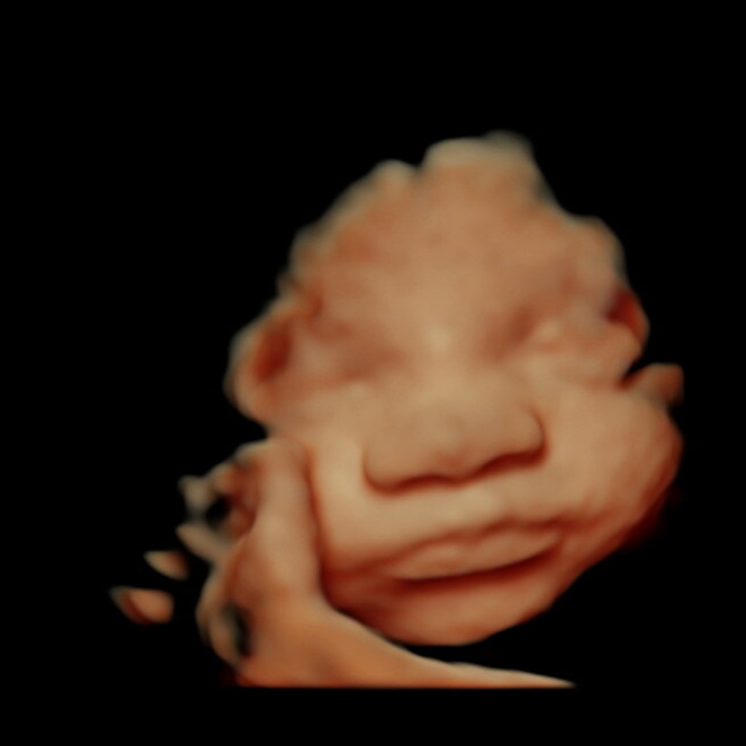 Photo shared by Kendal for their Babylist baby registry.