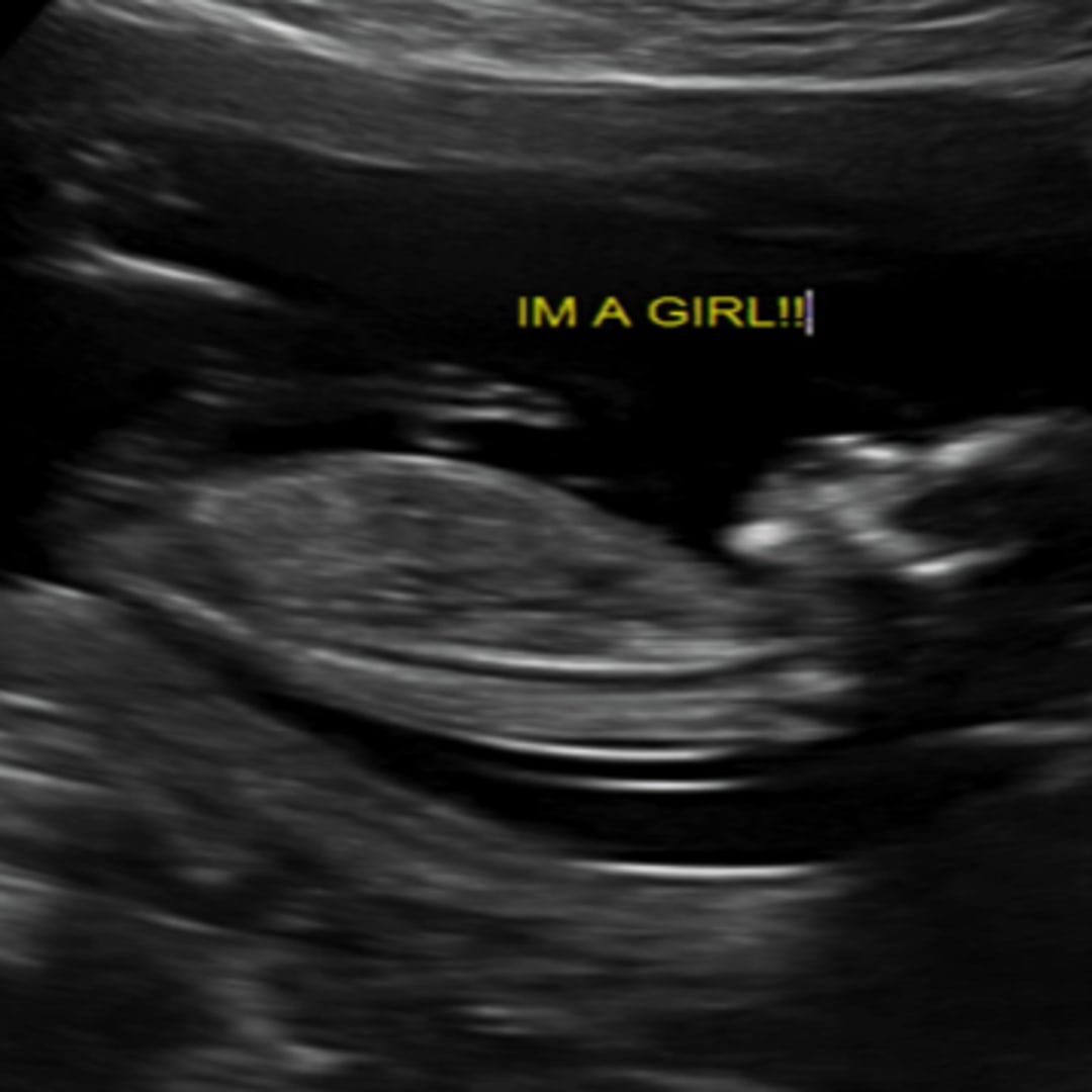 Photo shared by Kortney for their Babylist baby registry.