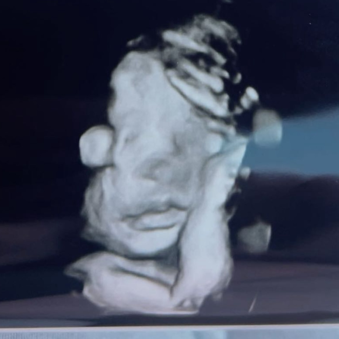 Photo shared by Amya for their Babylist baby registry.