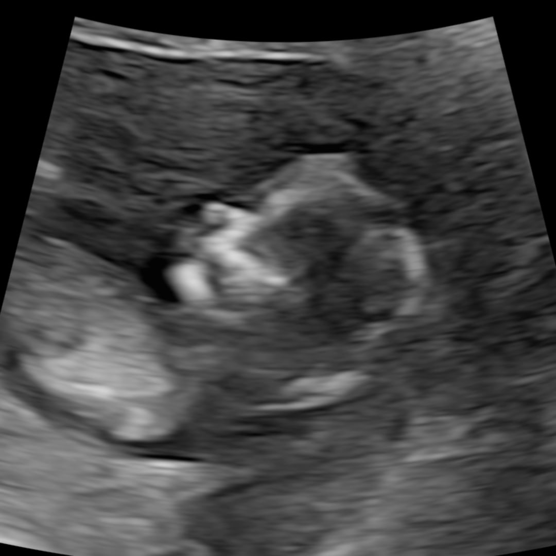 Photo shared by Deb for their Babylist baby registry.