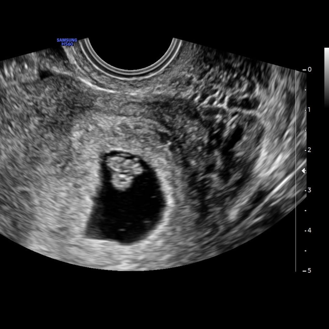 Photo shared by Izabella for their Babylist baby registry.