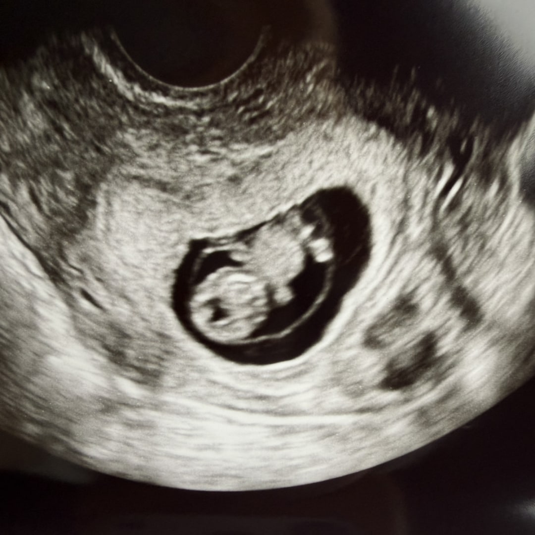 Photo shared by Katelyn for their Babylist baby registry.