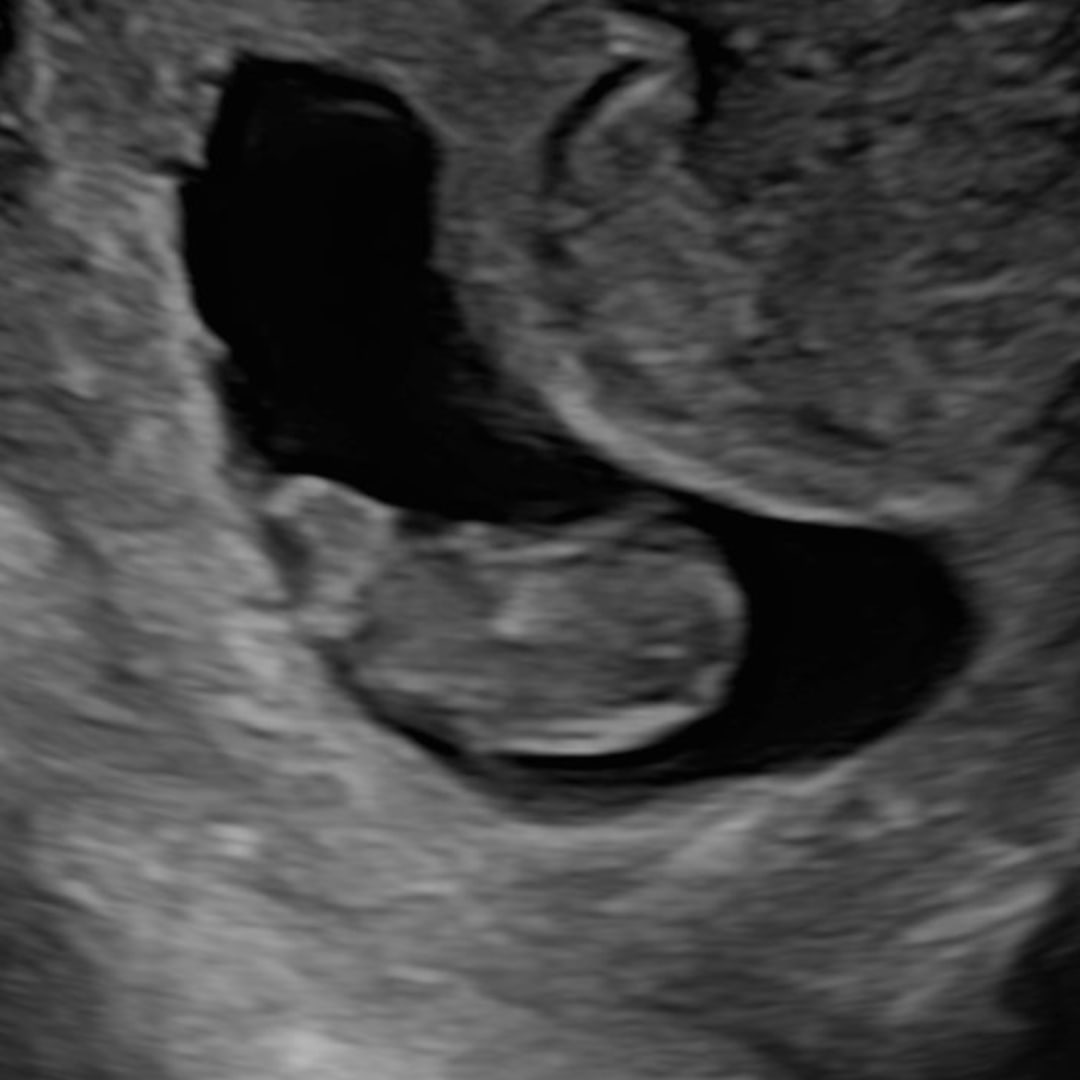 Photo shared by Kimberly for their Babylist baby registry.