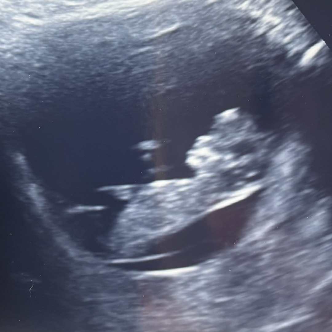 Photo shared by Savannah for their Babylist baby registry.