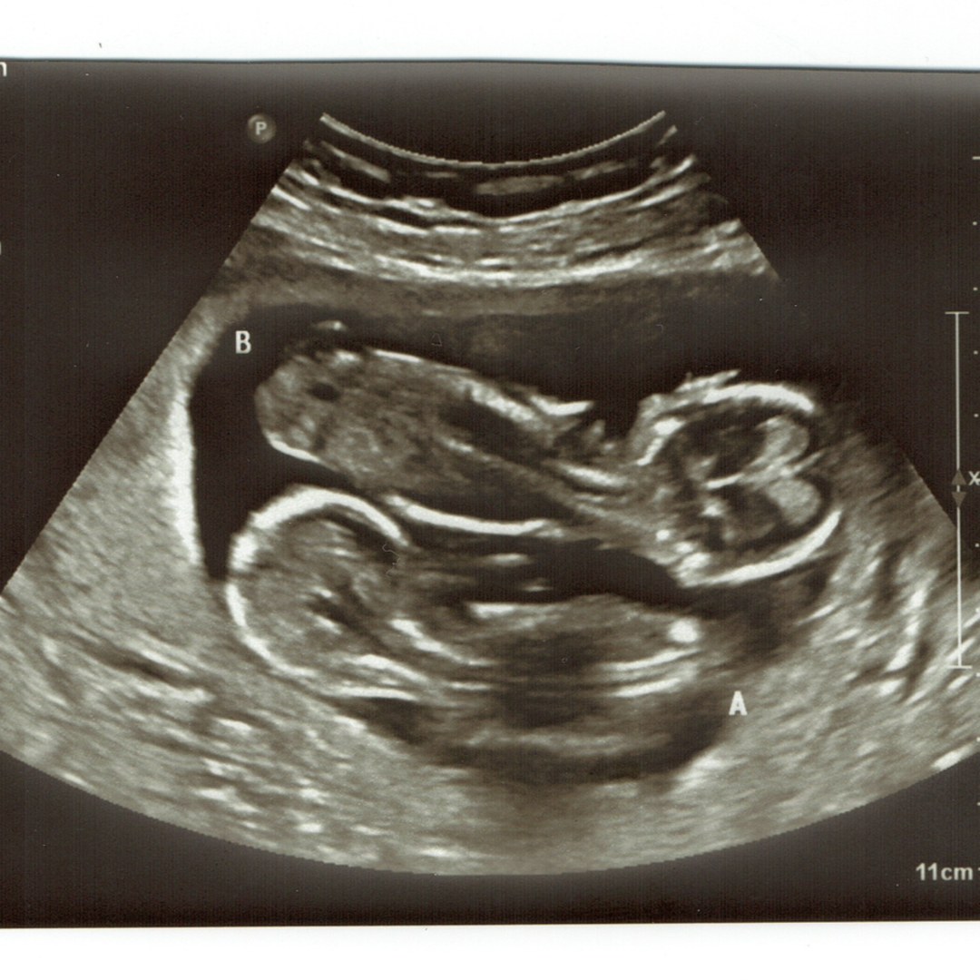 Photo shared by Patrick for their Babylist baby registry.