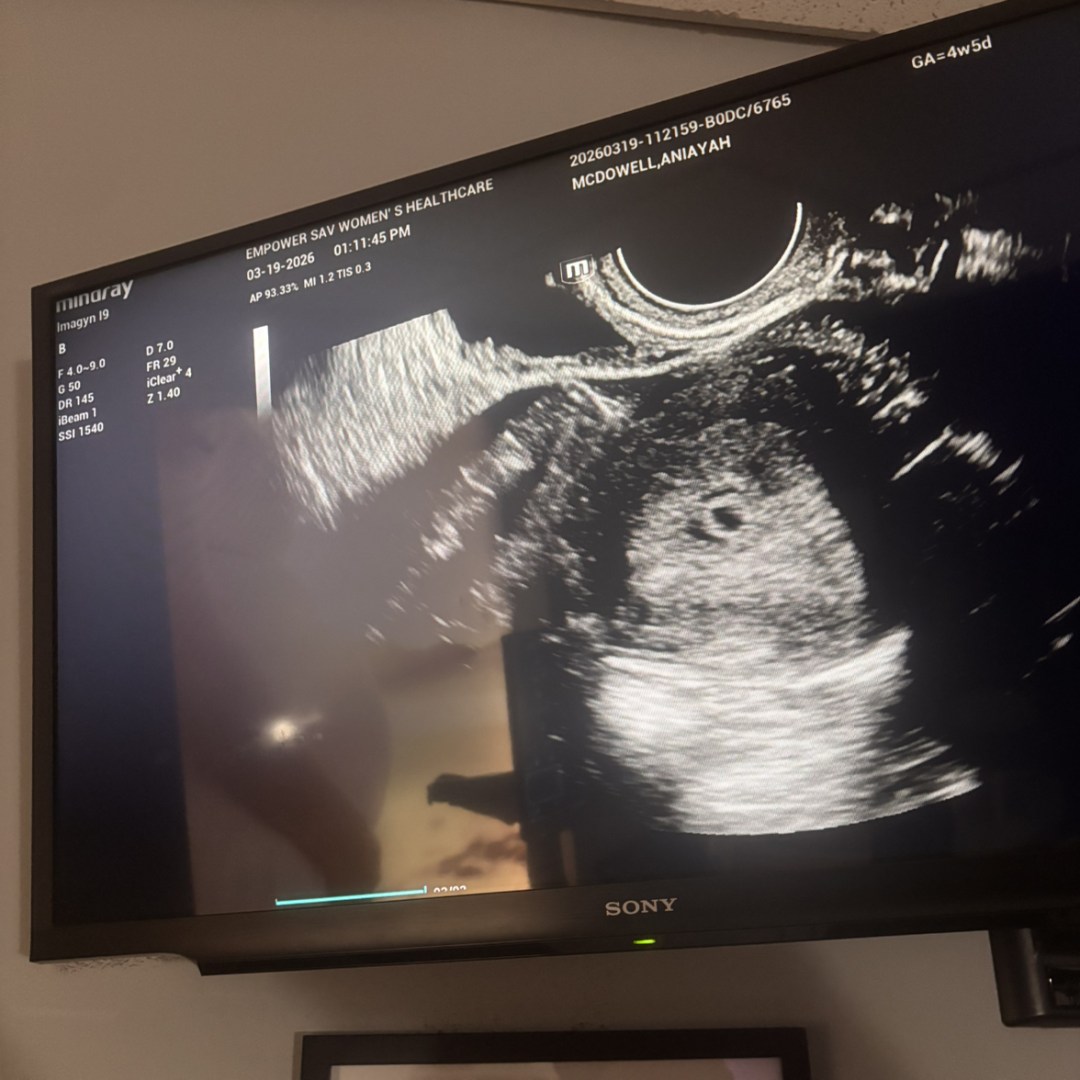 Photo shared by Aniayah for their Babylist baby registry.