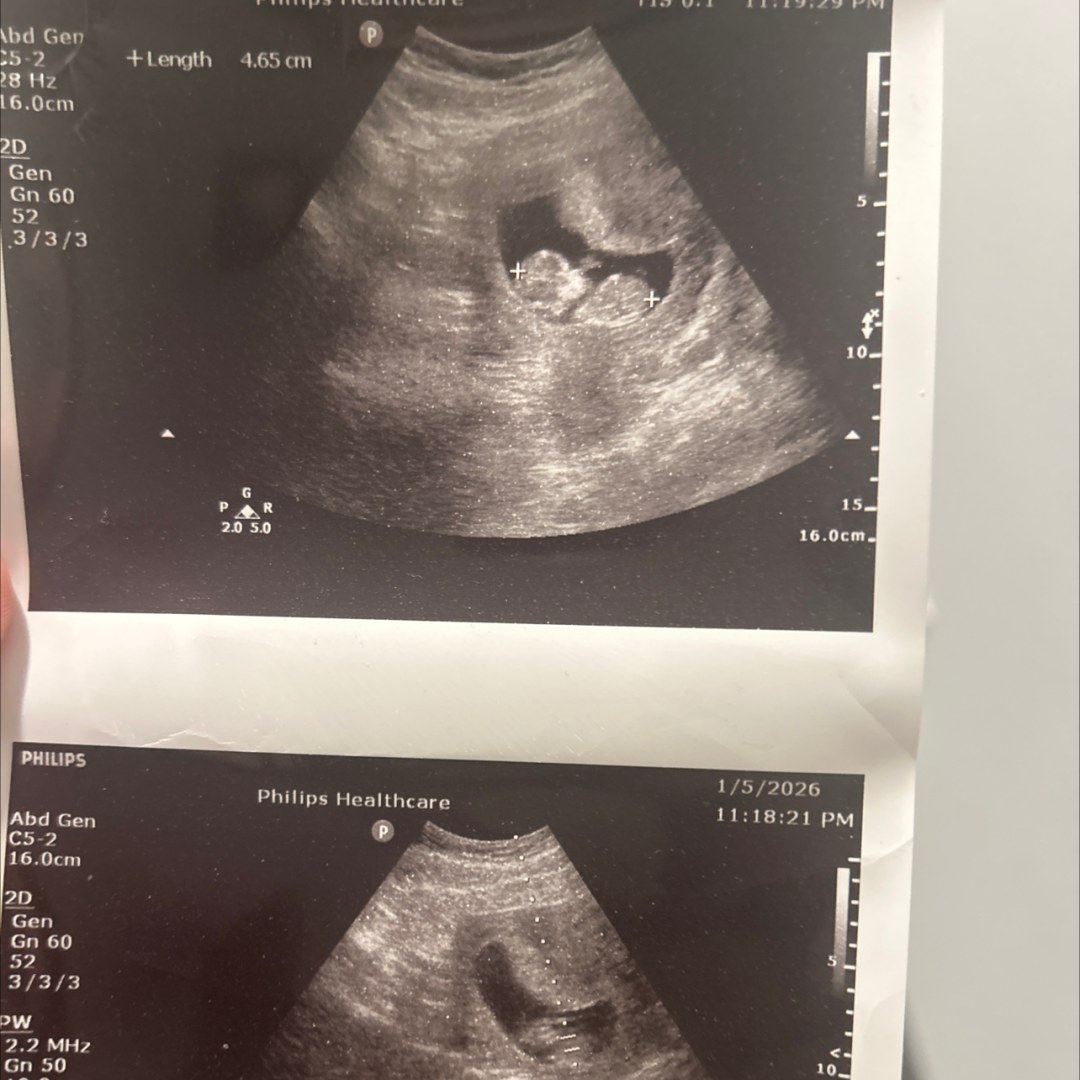 Photo shared by Alizely for their Babylist baby registry.