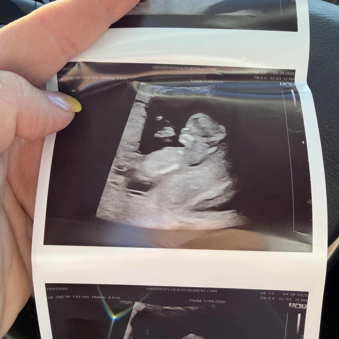 Photo shared by Dominique for their Babylist baby registry.