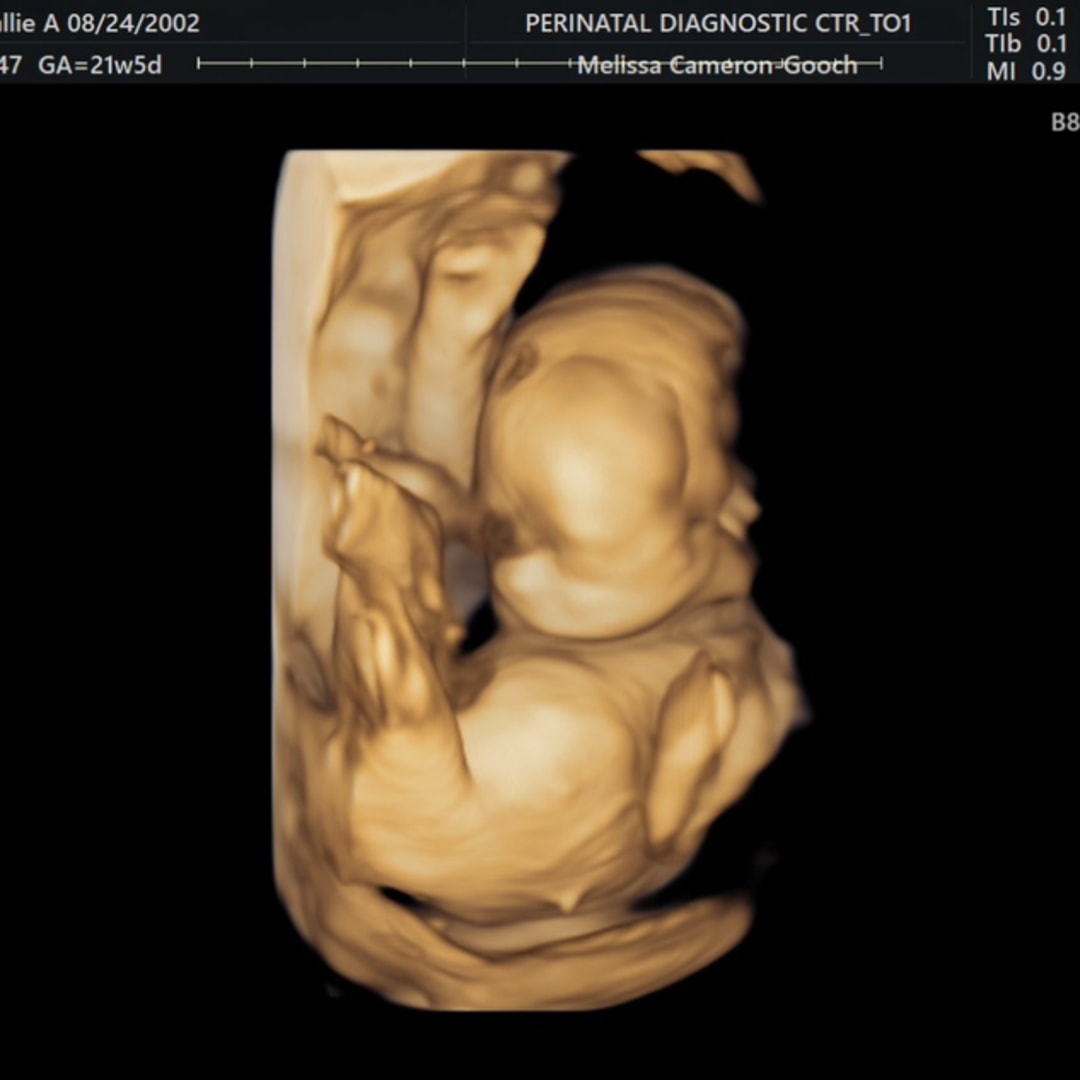 Photo shared by Callie for their Babylist baby registry.