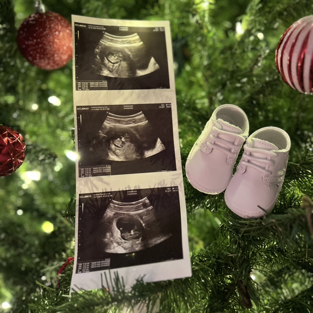 Photo shared by Grace for their Babylist baby registry.