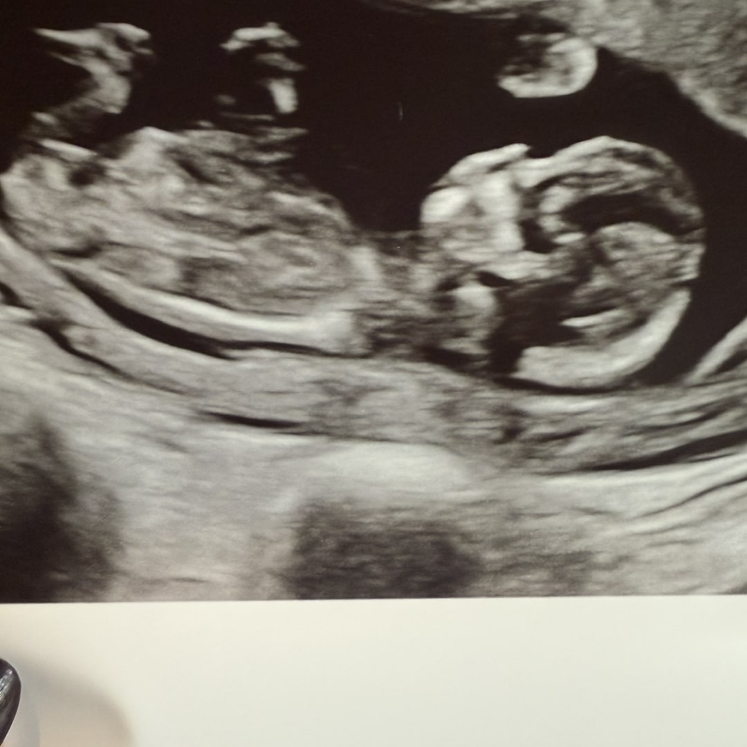 Photo shared by Kristen for their Babylist baby registry.