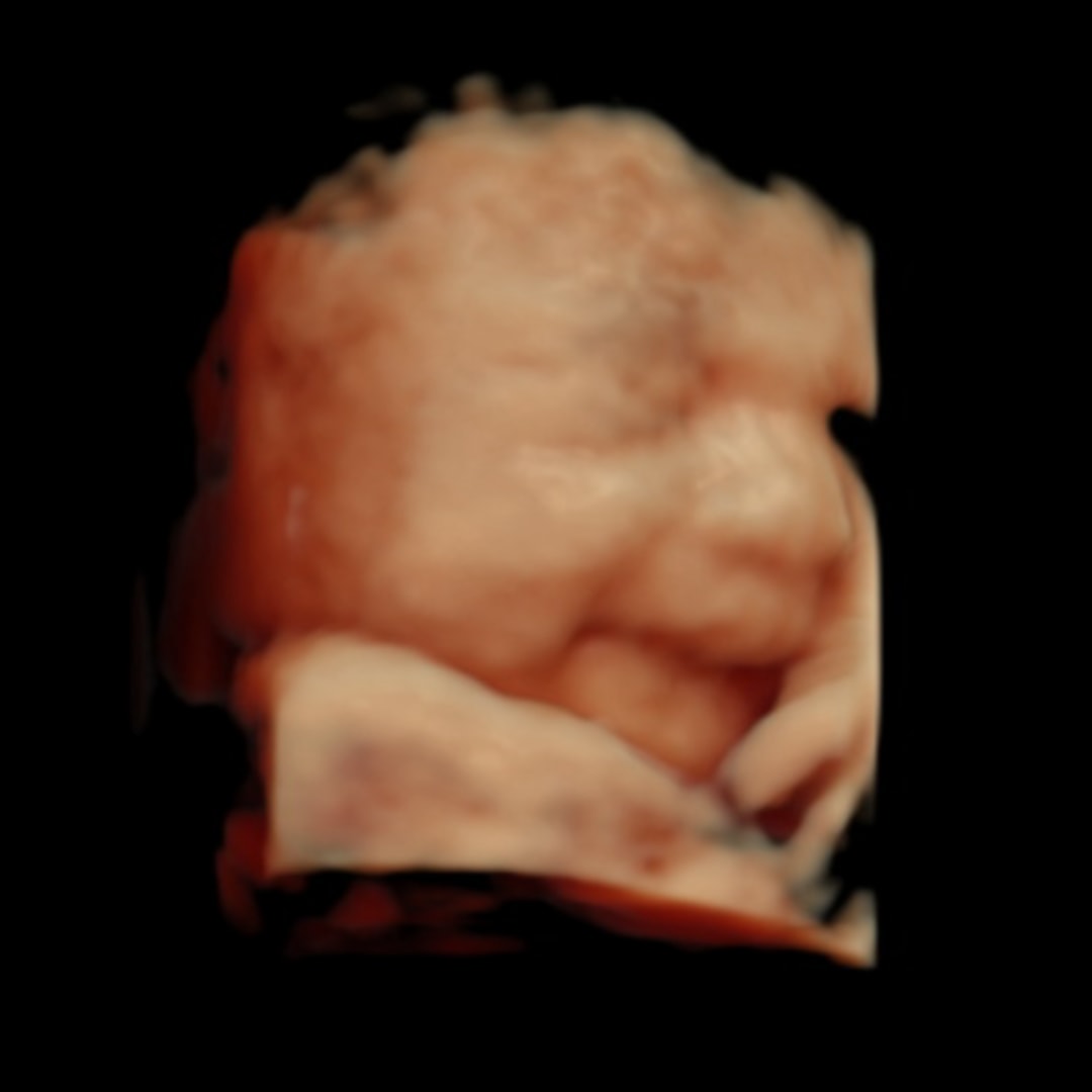 Photo shared by Michelle for their Babylist baby registry.