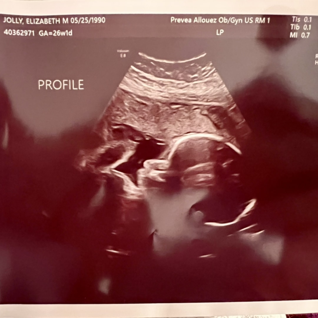 Photo shared by Elizabeth for their Babylist baby registry.