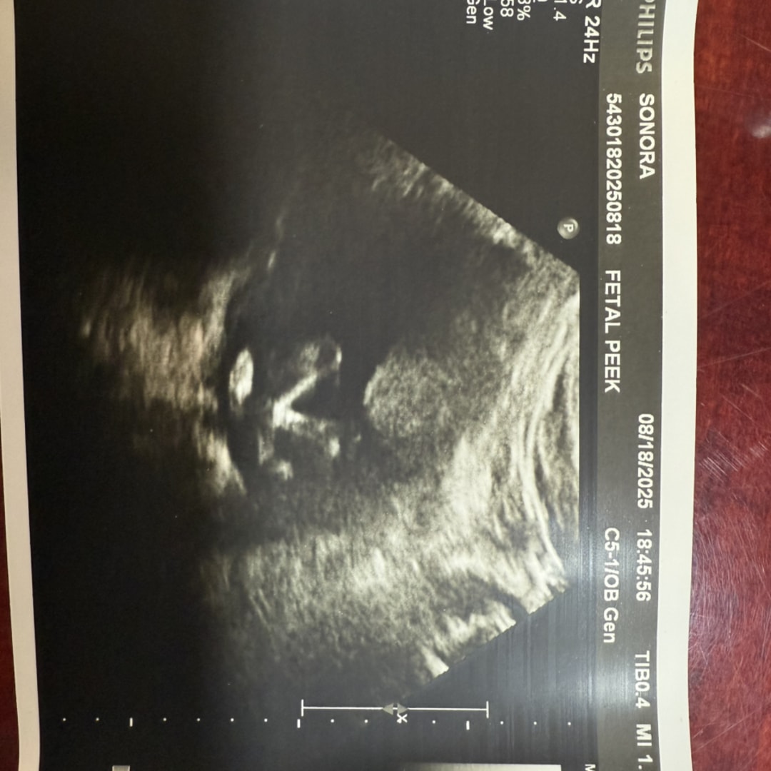 Photo shared by Sonora for their Babylist baby registry.