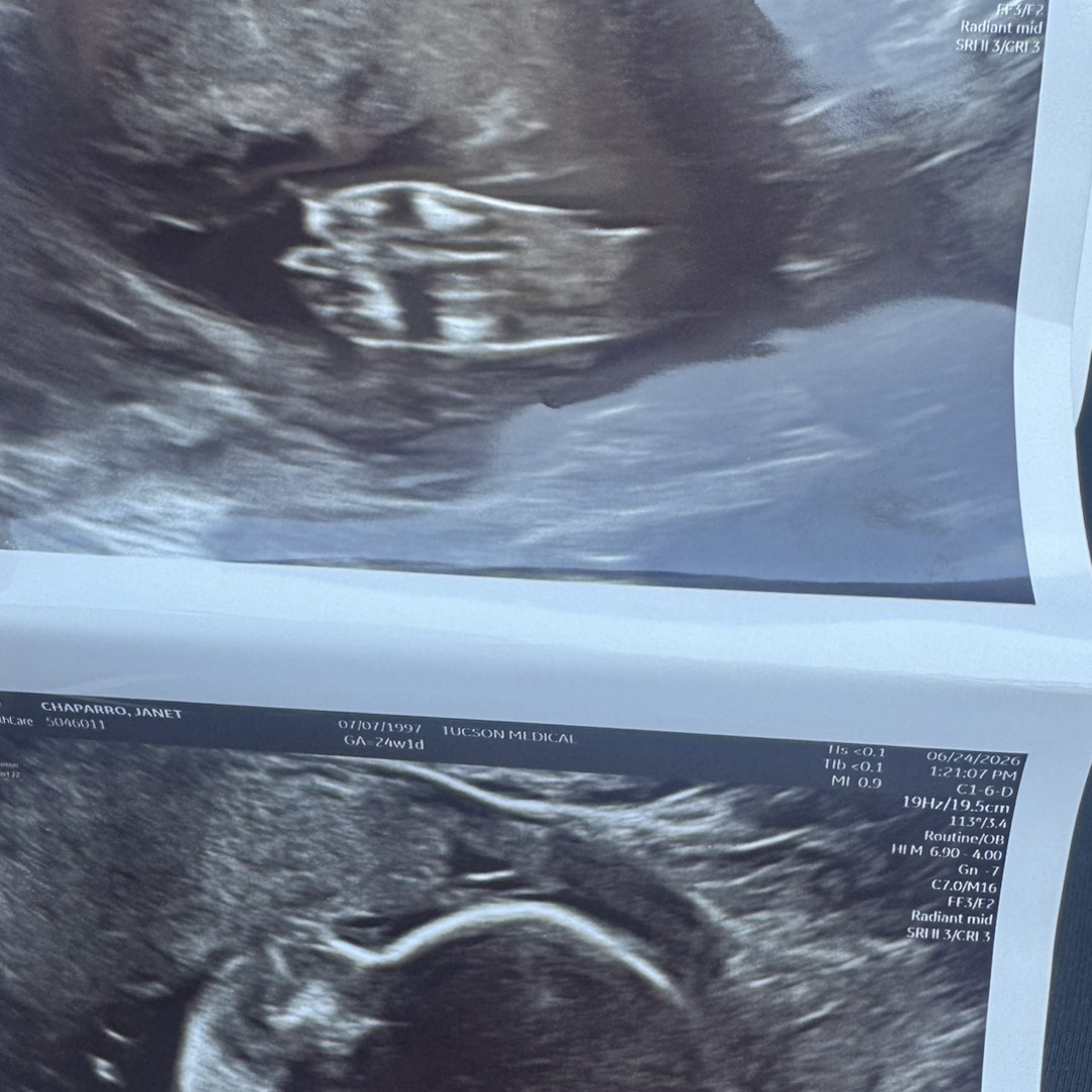 Photo shared by Janet for their Babylist baby registry.