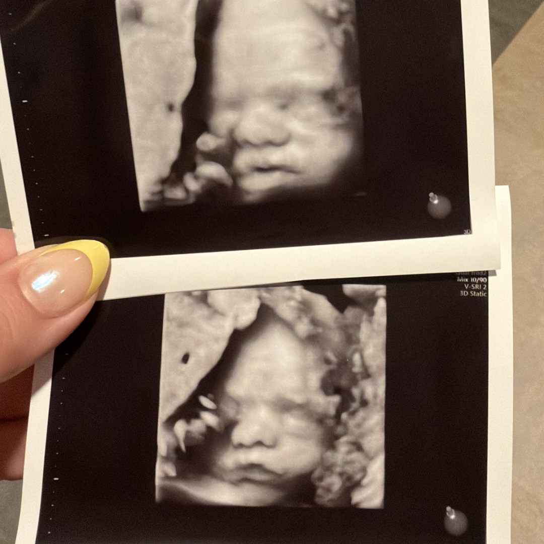 Photo shared by Abigail for their Babylist baby registry.