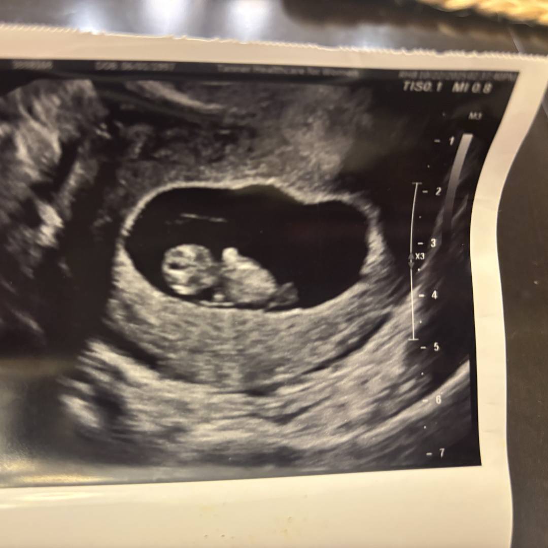 Photo shared by Morgan for their Babylist baby registry.