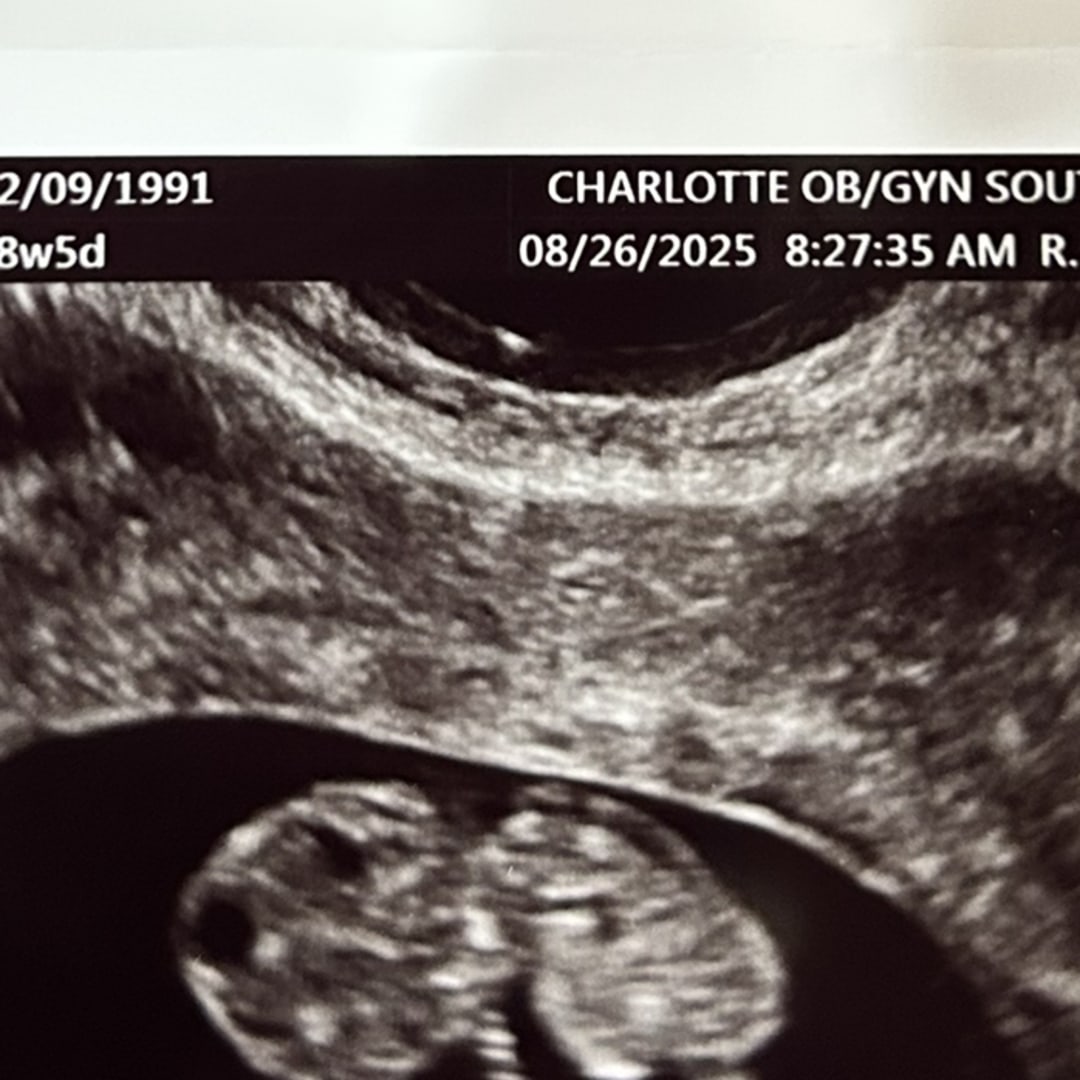 Photo shared by Emma for their Babylist baby registry.