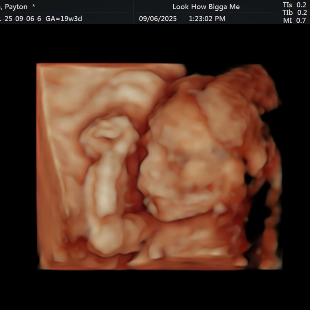 Photo shared by Payton for their Babylist baby registry.