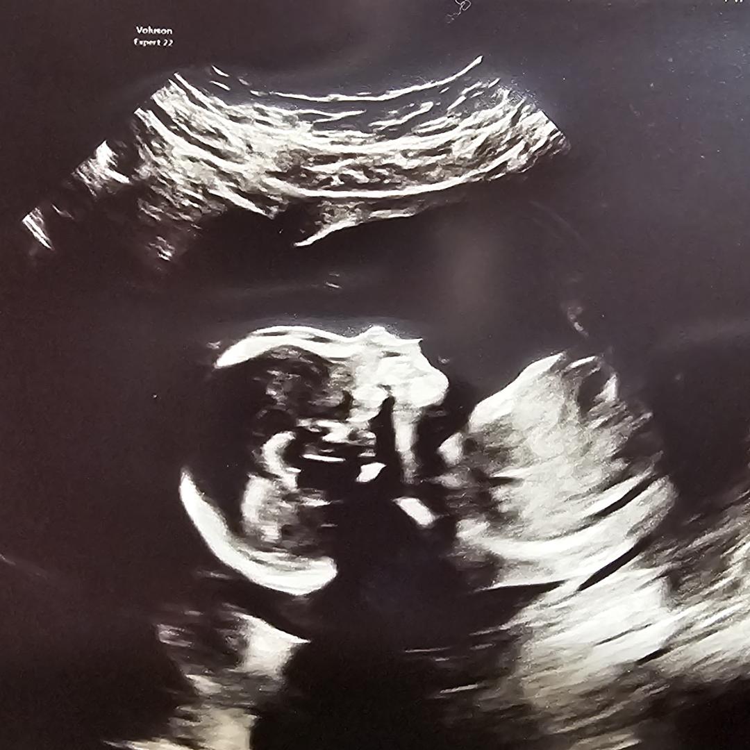 Photo shared by Brie for their Babylist baby registry.