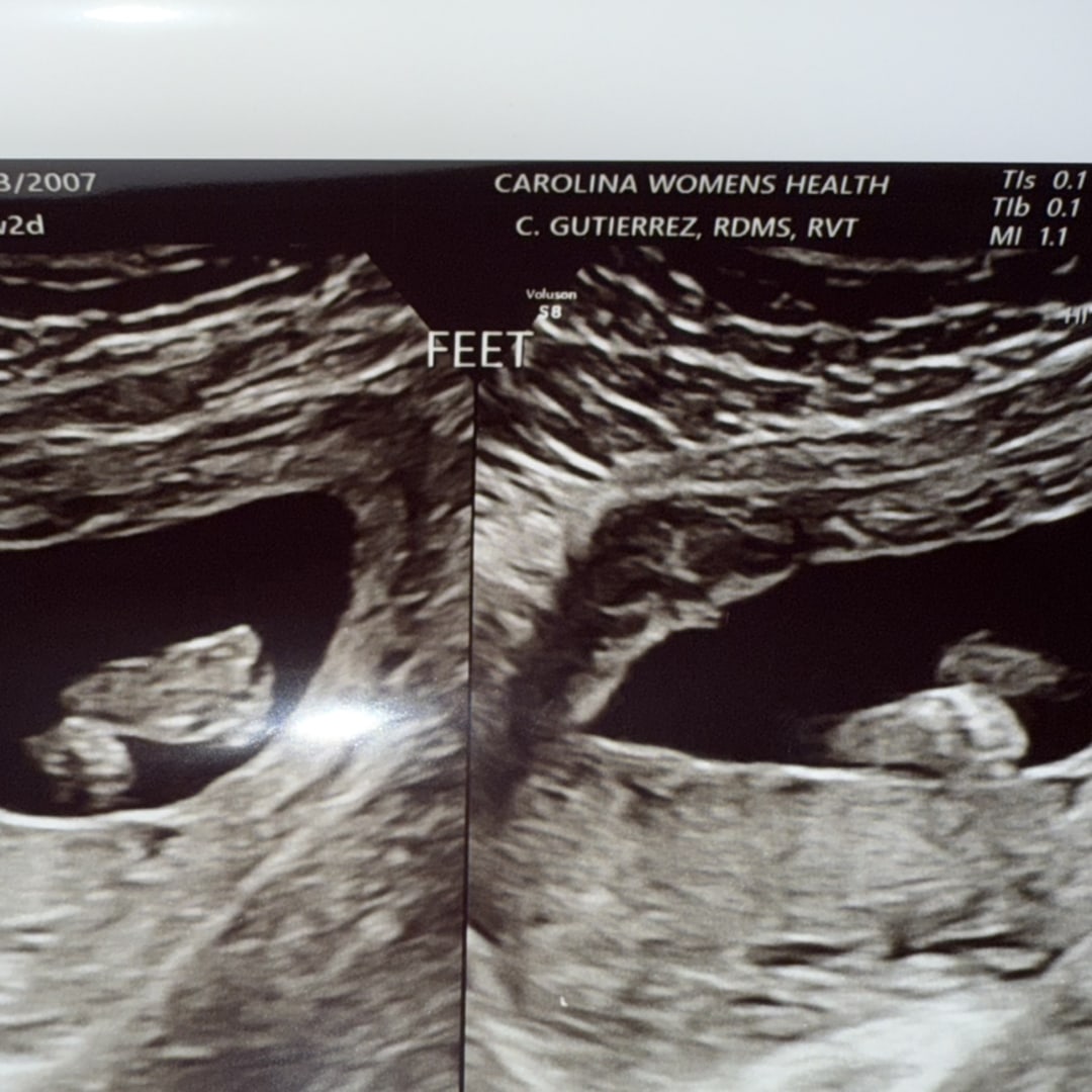 Photo shared by Dezire for their Babylist baby registry.