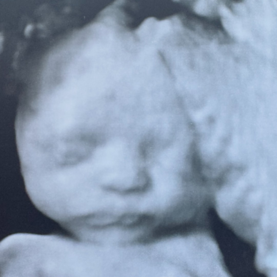 Photo shared by Ashley for their Babylist baby registry.