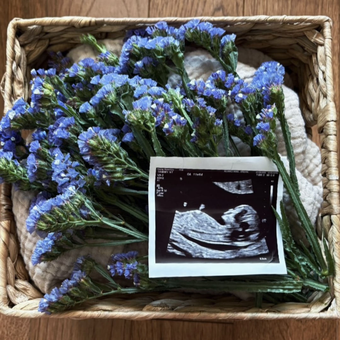 Photo shared by Rosemary for their Babylist baby registry.