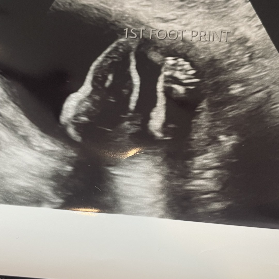 Photo shared by Schuyler for their Babylist baby registry.